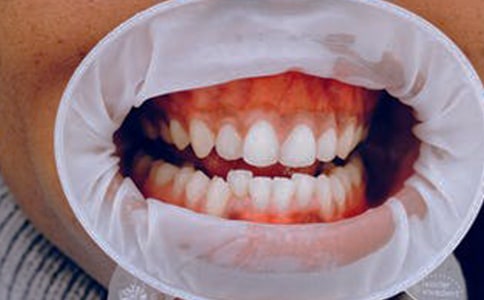 ��ð���l�[ʹ��ô�k